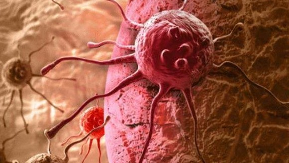 Nhiều người sợ ung thư nhưng không biết rằng ung thư cũng "sợ" 5 điều này