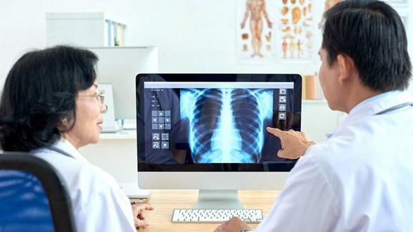 Sách trắng về ứng dụng trí tuệ nhân tạo cho chẩn đoán và tầm soát bệnh lao