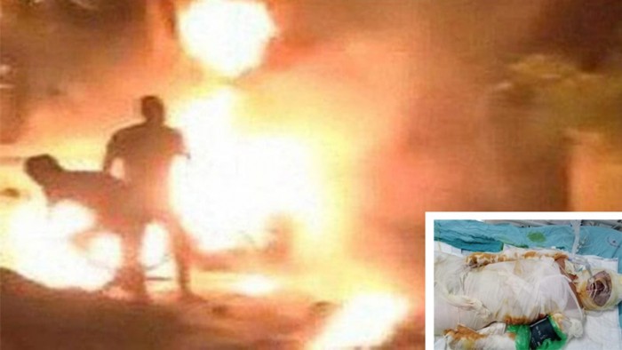 Hành vi của bị can Tuấn Anh đã gây cháy phòng trọ, làm người tình tử vong và bản thân bị bỏng 42% (Ảnh lớn, cắt từ clip lưu lại từ camera nhà hàng xóm)
Chị N. bị bỏng 92% sau đó đã tử vong (Ảnh nhỏ)