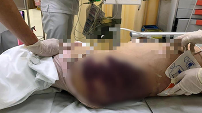 Bắt khẩn cấp người phụ nữ bạo hành làm bé gái 8 tuổi tử vong