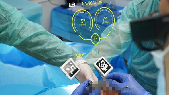 Đưa công nghệ thực tế ảo “mắt thần” vào thay khớp nhân tạo