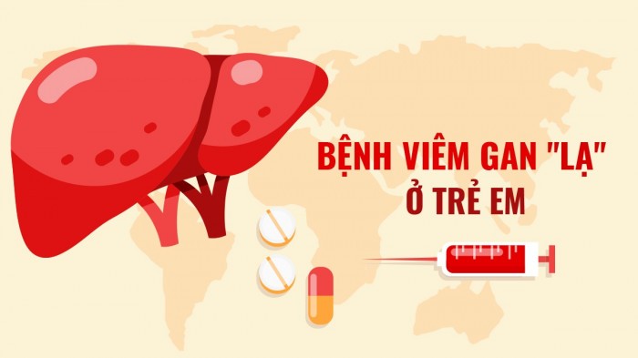 Làm gì để bảo vệ con tránh viêm gan “bí ẩn”?