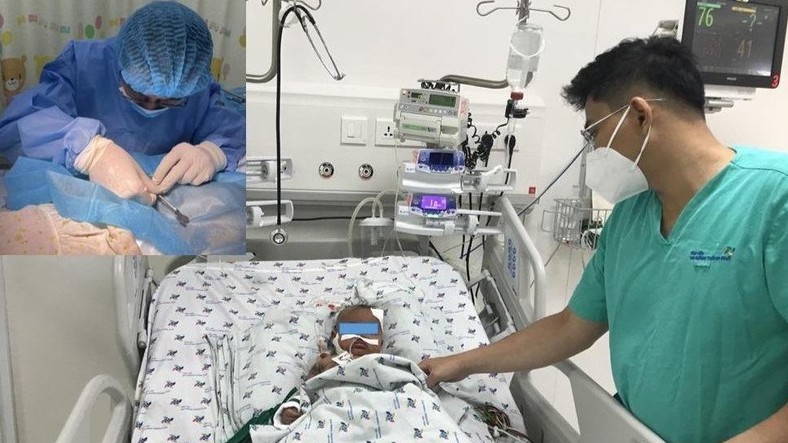 Cứu sống bệnh nhi bị xuất huyết tiêu hóa nặng do nhiễm giun