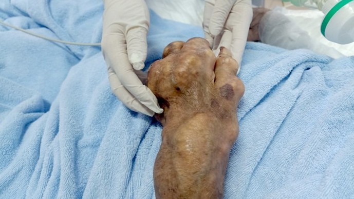 Hệ lụy từ sai lầm trong điều trị bệnh “nhà giàu”