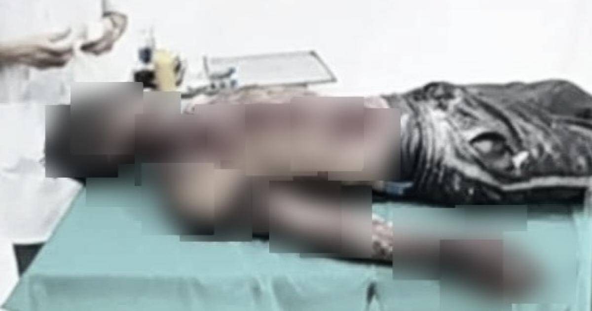 Thợ hàn xì ở Thái Bình nhập viện cấp cứu trong tình trạng đa vết thương sau vụ nổ bình oxy.