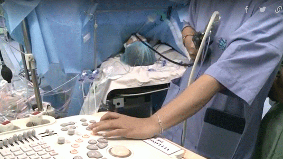 Bác sĩ mổ tim cả ngày, thù lao 140.000 đồng