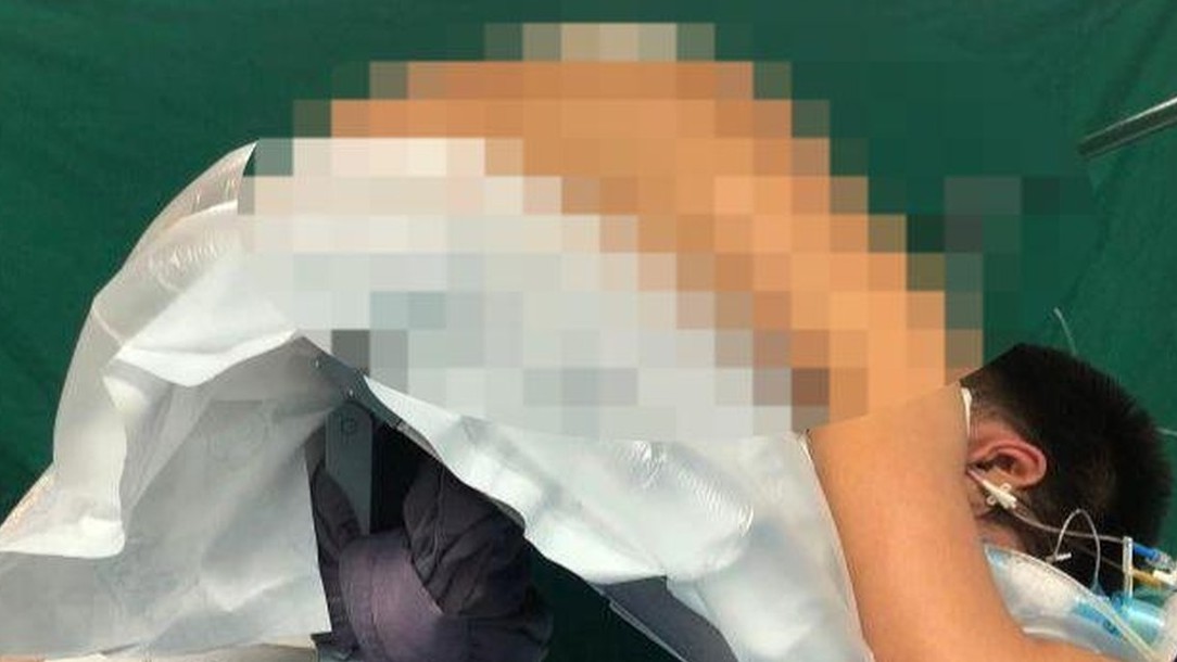 Chỉnh cột sống cho người 10 năm không thể nằm ngửa