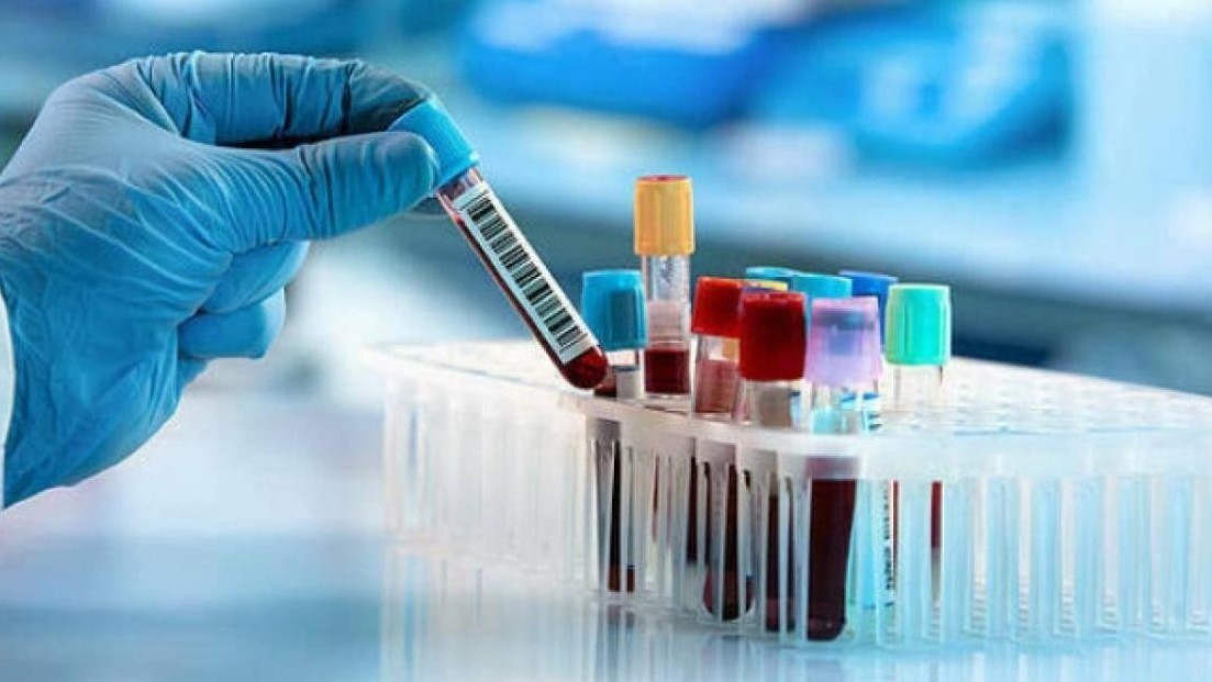 Phó Chủ tịch Hội Huyết học - Truyền máu nói gì về máu nhân tạo?