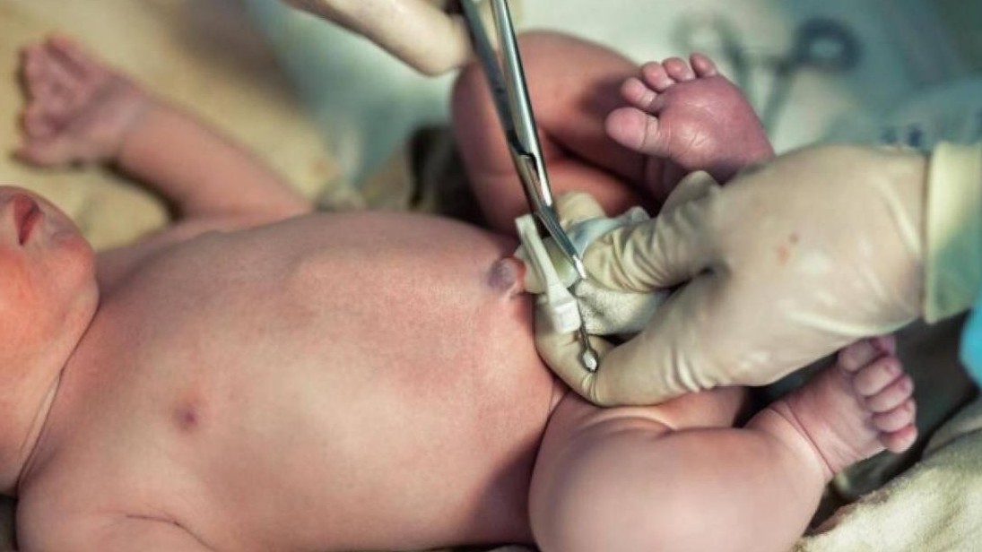 Gửi tế bào gốc máu cuống rốn mất vài chục triệu đồng, có thực sự cần thiết?