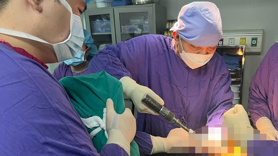 Tìm ra nguyên nhân mới khiến gia tăng người trẻ bị hoại tử chỏm xương đùi