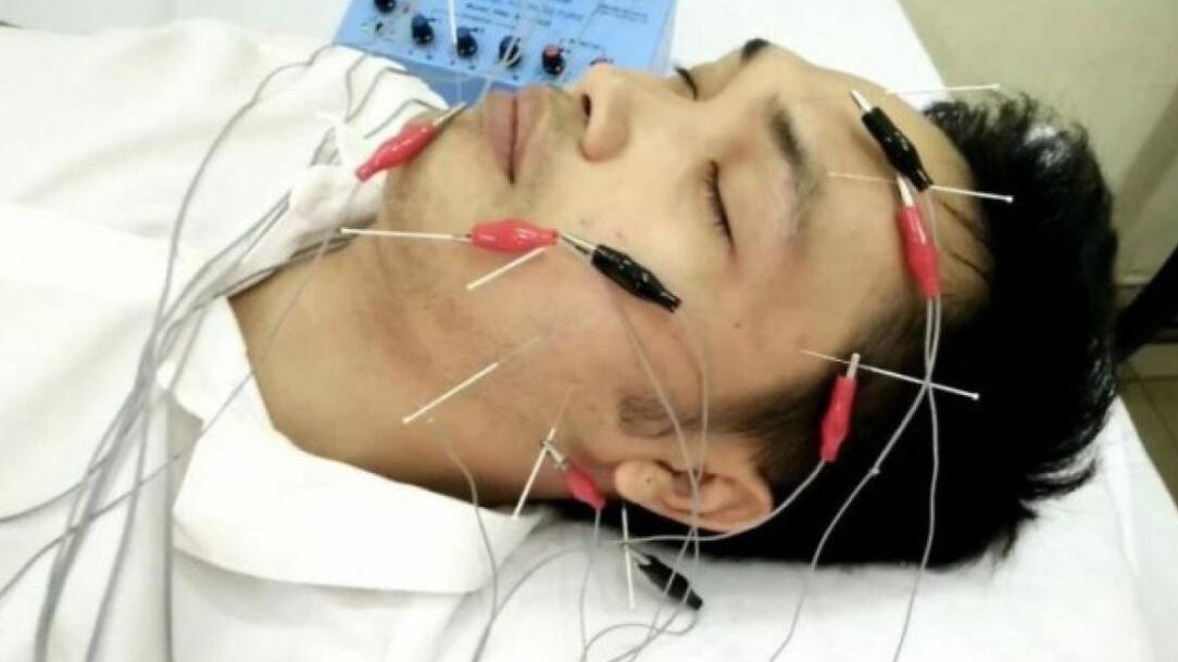 Thời tiết lạnh sâu, không chủ quan khi đột ngột tê mặt, lệch miệng