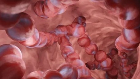 Australia khuyến cáo dân thận trọng khi số ca nhiễm khuẩn xâm lấn tăng