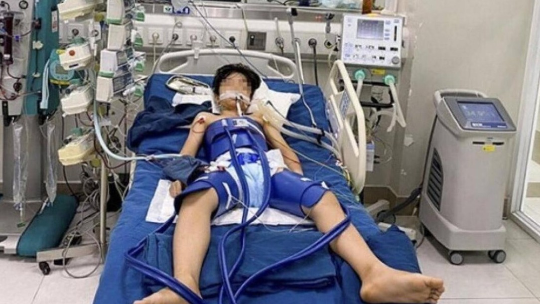 Ngoạn mục cứu sống bé trai đột ngột ngừng tim sau pha bắt bóng