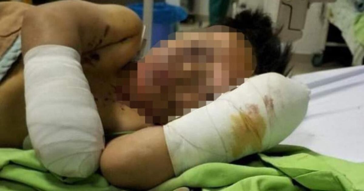 Bé trai đang được điều trị tại bệnh viện.