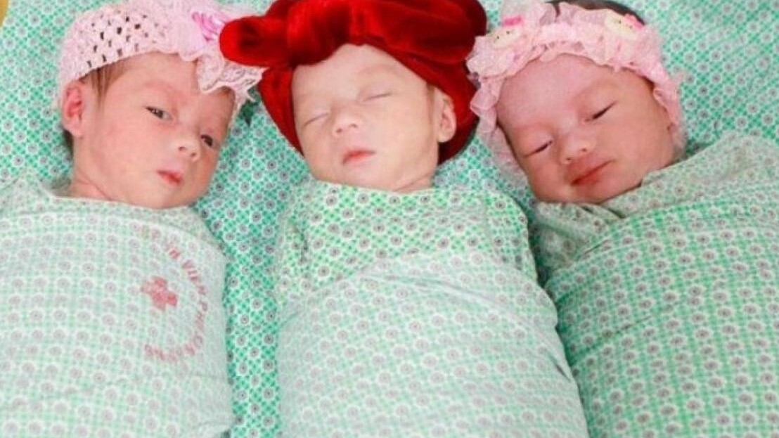 Mổ đẻ thành công ca sinh 3 tự nhiên cùng trứng hiếm gặp
