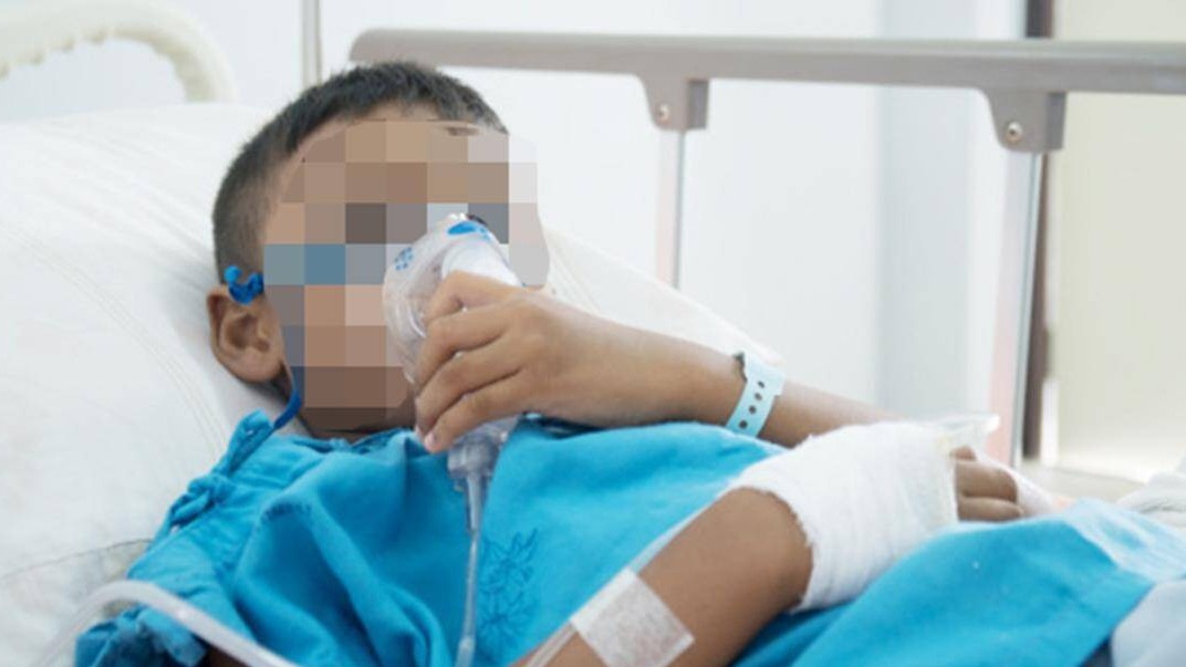 Dấu hiệu nào nhận biết lao ở trẻ nhỏ?