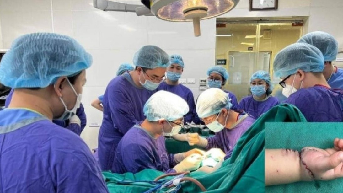 8 giờ căng thẳng nối lại bàn tay bị đứt rời cho bé trai 21 tháng tuổi