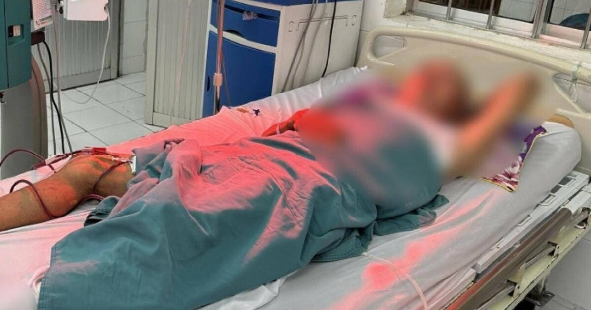 1 trong 5 người nghi bị ngộ độc rượu được điều trị tại bệnh viện