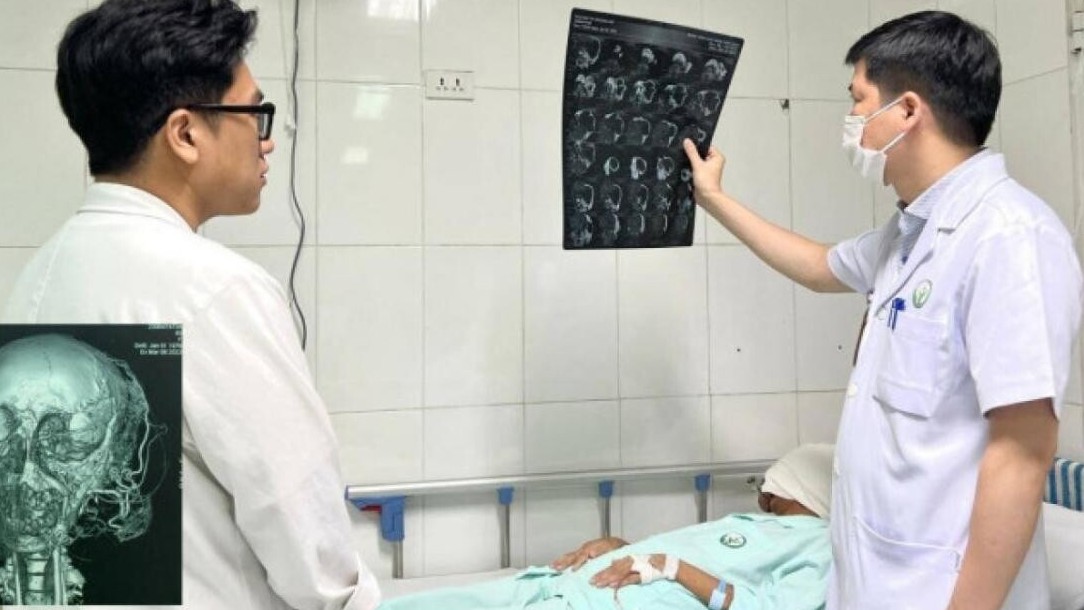 Giải thoát khối u khổng lồ trên khuôn mặt nữ bệnh nhân ở Thái Bình