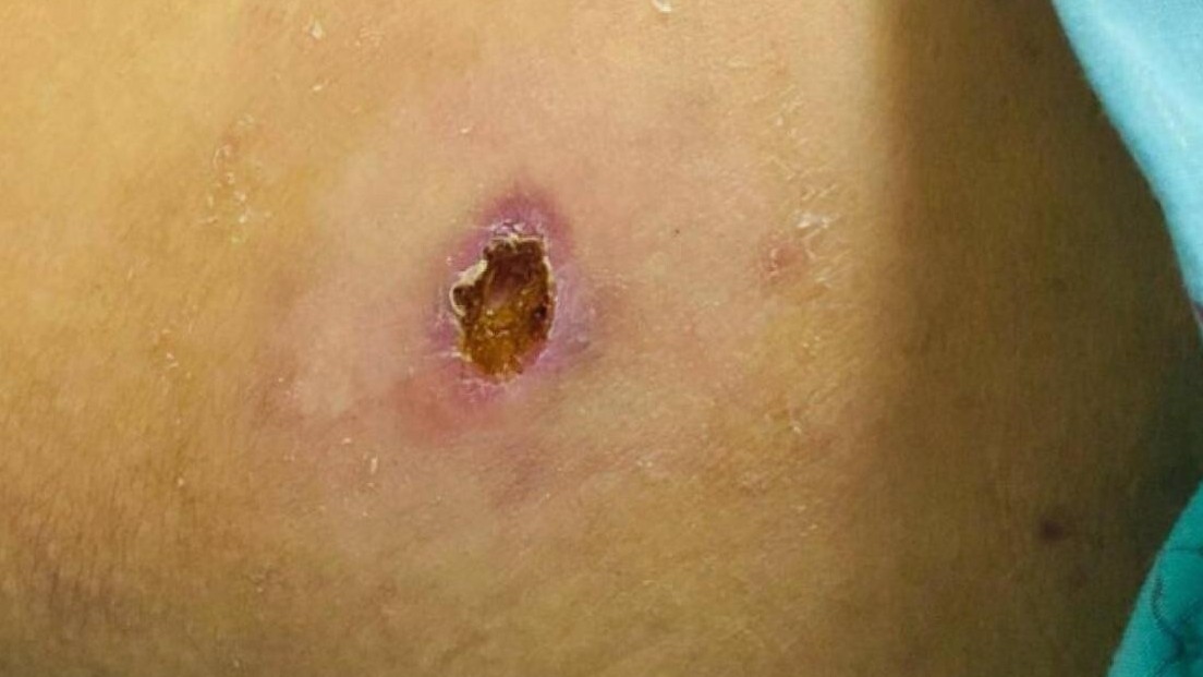 Cảnh báo sốt mò trở lại sau một thời gian dài tạm lắng