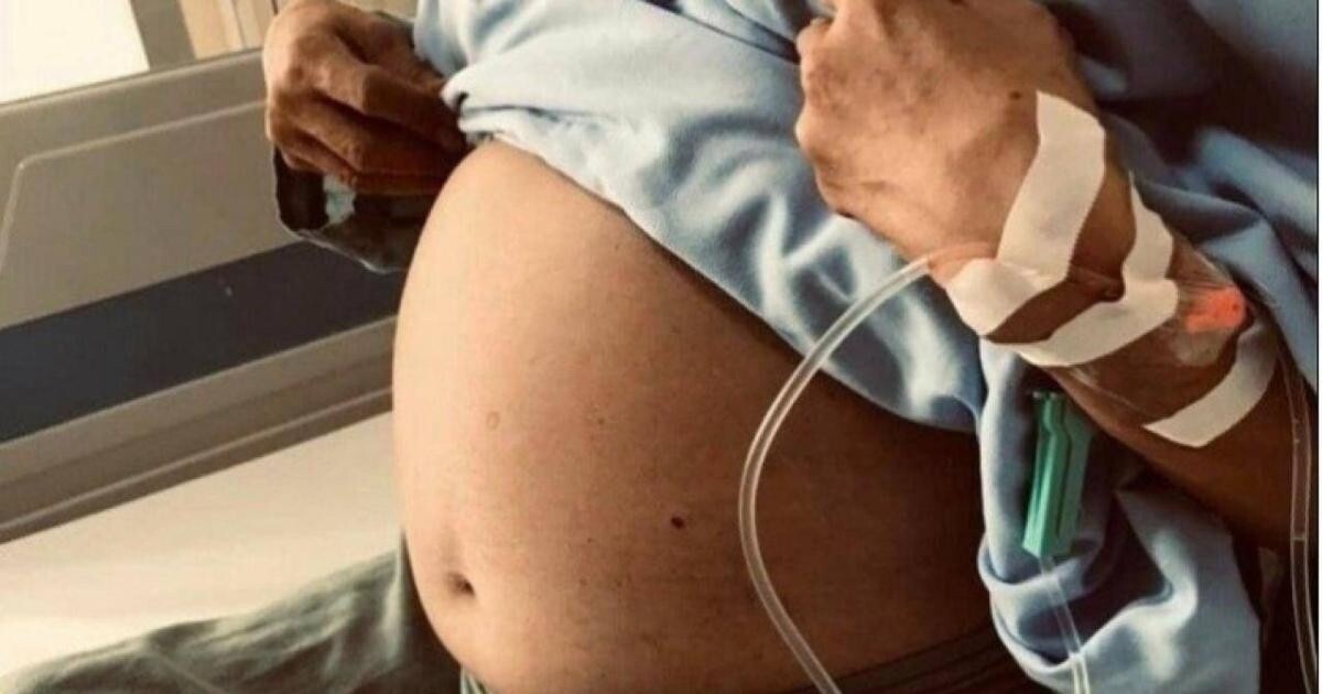 Các bác sĩ đã bóc thành công khối u nặng gần 6kg cho nữ bệnh nhân 50 tuổi ở Hà Nội.