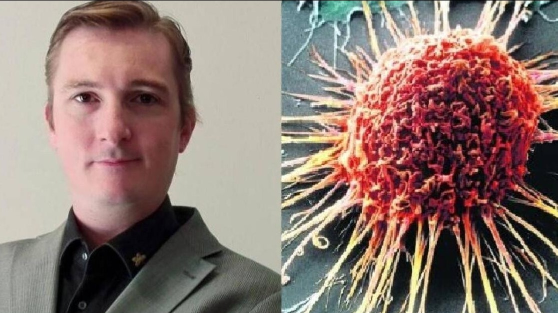 8 dấu hiệu cảnh báo khối u: Chuyên gia dặn có 1 cũng phải đi khám