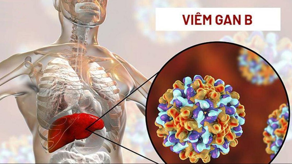 Ai nên sàng lọc viêm gan B tiềm ẩn?