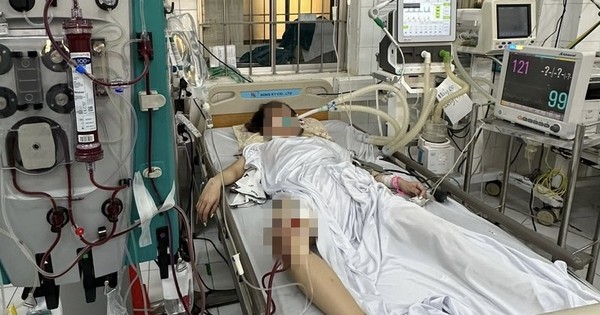 Một trong hai bệnh nhân ngộ độc Methanol đang được điều trị tích cực tại Bệnh viện đa khoa Cà Mau.