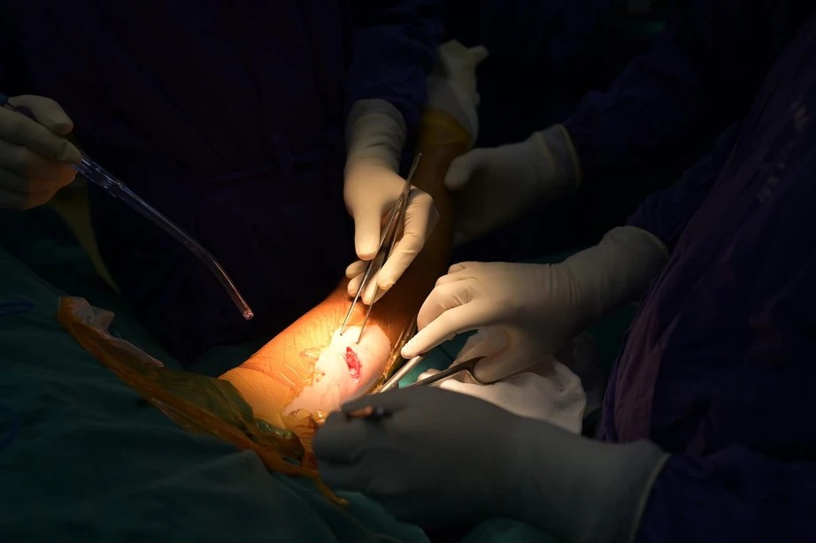 Bệnh nhân đa chấn thương đã qua cơn nguy kịch.