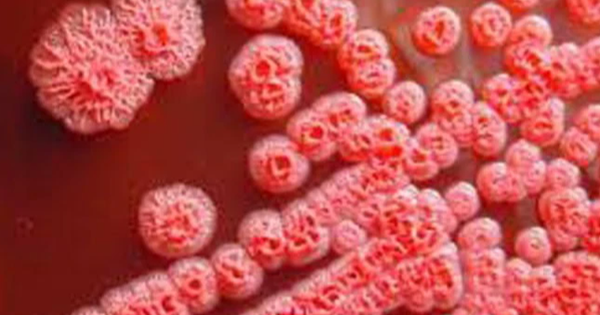 Bệnh Whitmore là một bệnh nhiễm trùng ở người và động vật do vi khuẩn Burkholderia Pseudomalle gây ra.