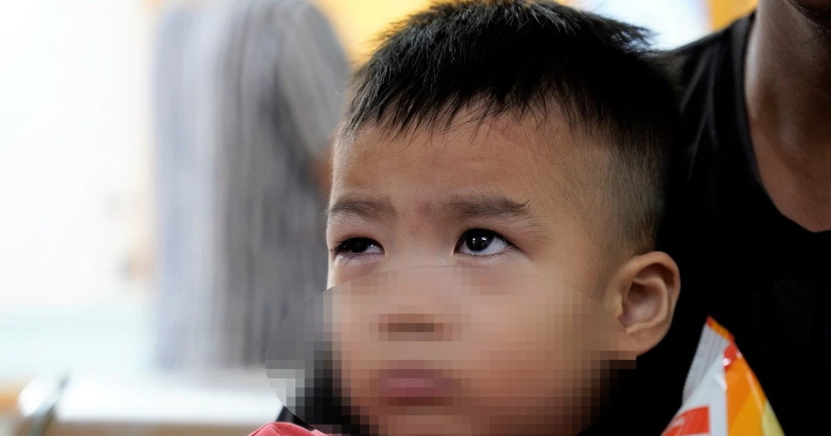 Vì sao không nên nhỏ sữa, xông lá trầu khi điều trị đau mắt đỏ