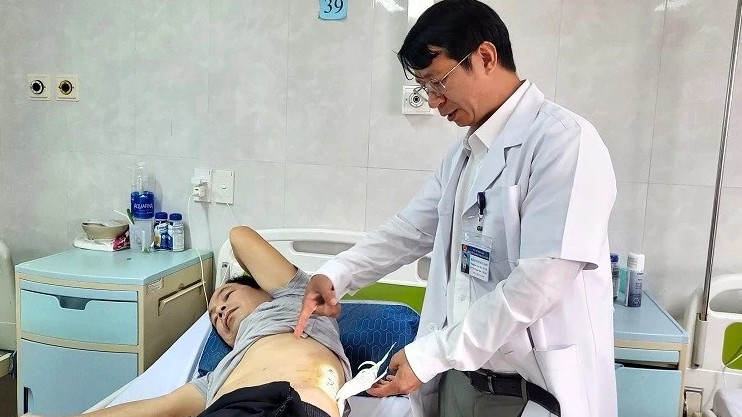 Đắk Lắk: Phẫu thuật thành công bệnh nhân mắc sỏi san hô trên nền thận dị tật móng ngựa