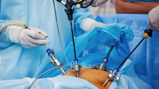 Vì sao cần can thiệp sớm dù sỏi túi mật chưa có triệu chứng?