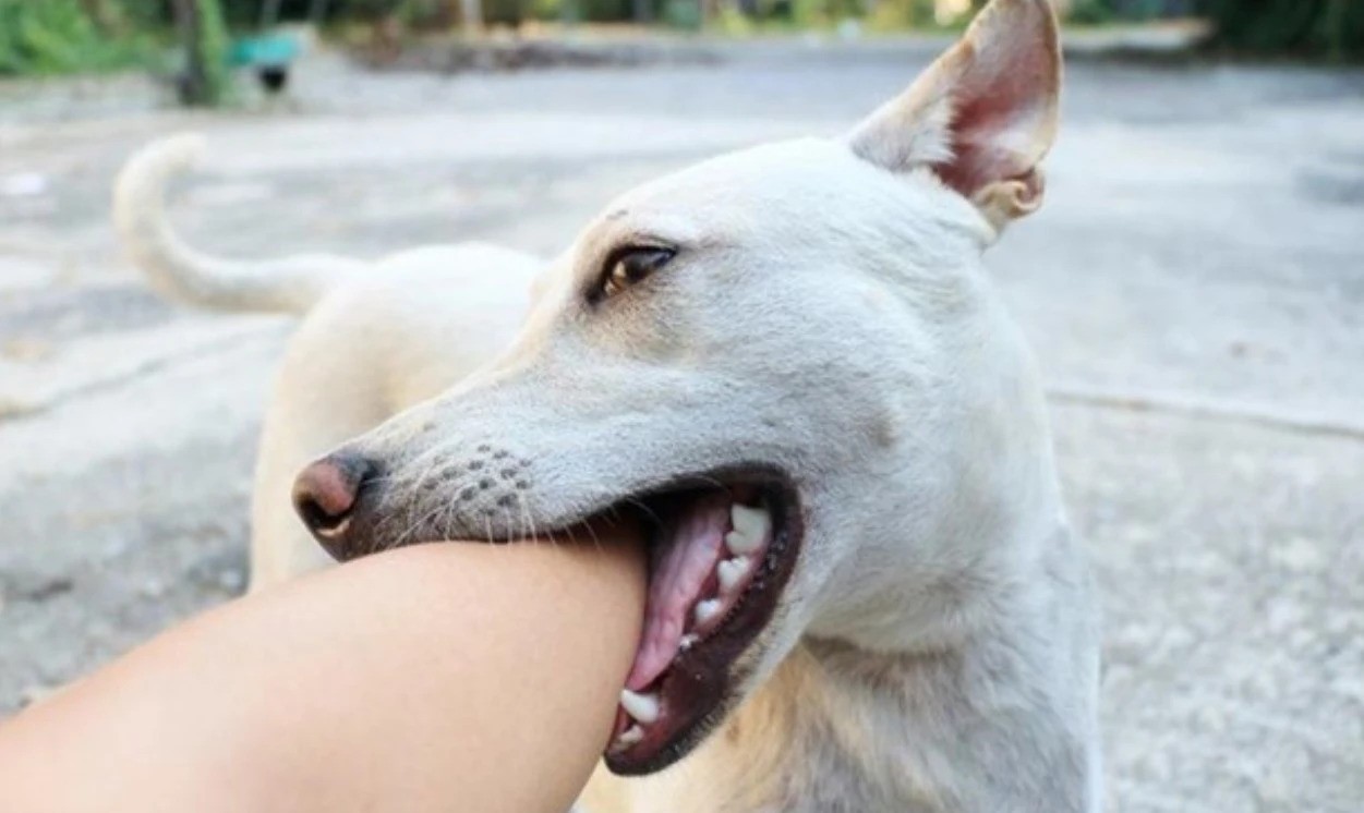 Khi bị chó cắn cần đến ngay cơ sở y tế để xử lý vết thương tránh bị nhiễm trùng (Ảnh minh họa.).