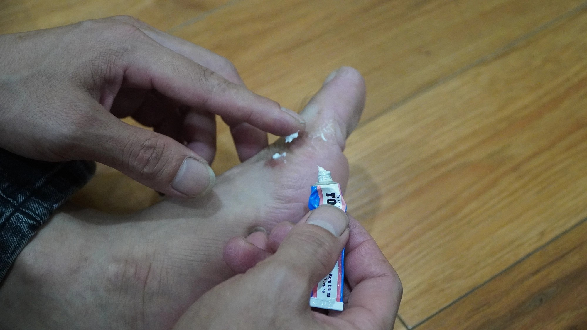 Nhiều cư dân ở Thanh Hà (Hà Nội) ngứa ngáy, lở loét (Ảnh: Hoàng Anh).