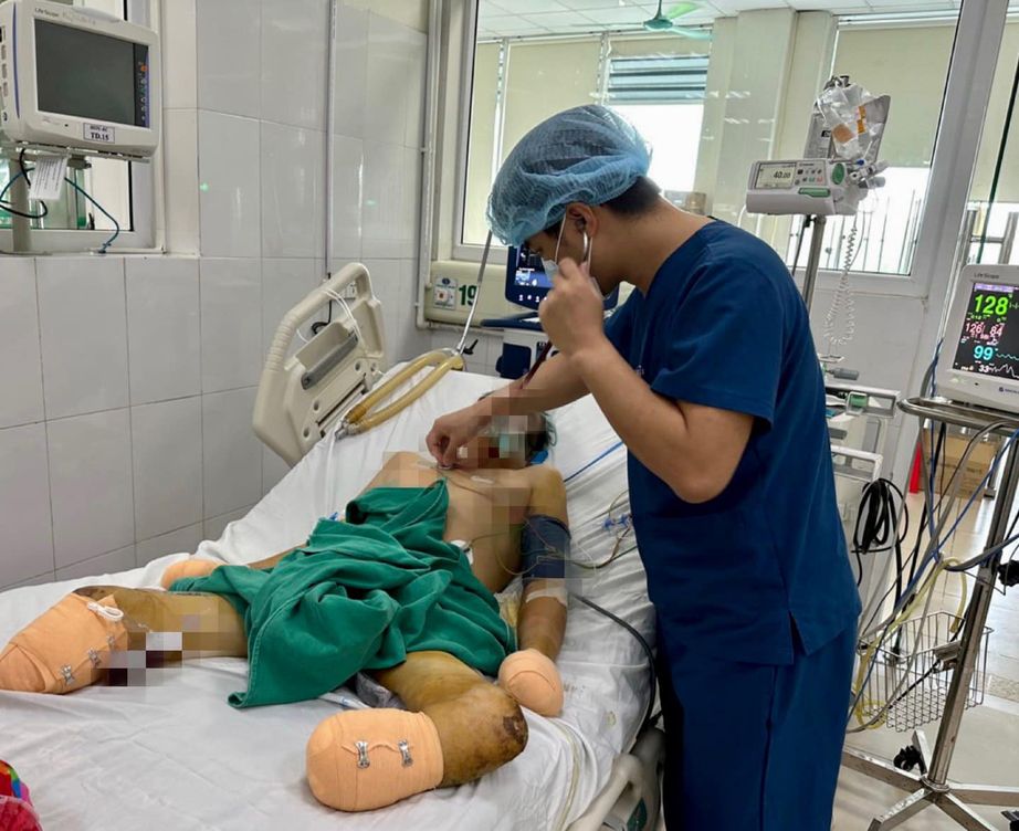 Thích ăn nem chạo, thịt lợn sống, người đàn ông nguy kịch vì nhiễm khuẩn liên cầu lợn