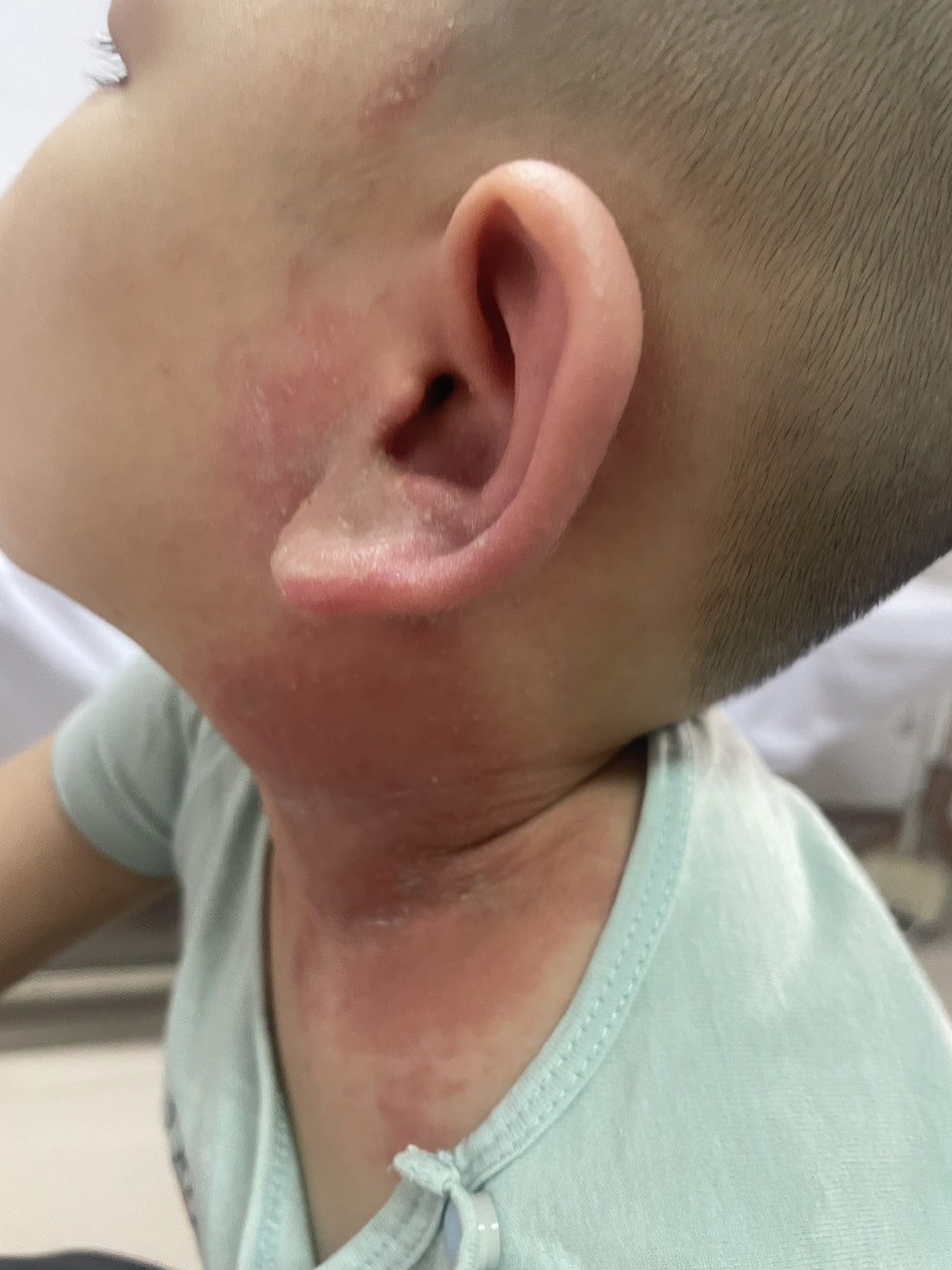 Nhiều người khốn khổ vì kiến ba khoang