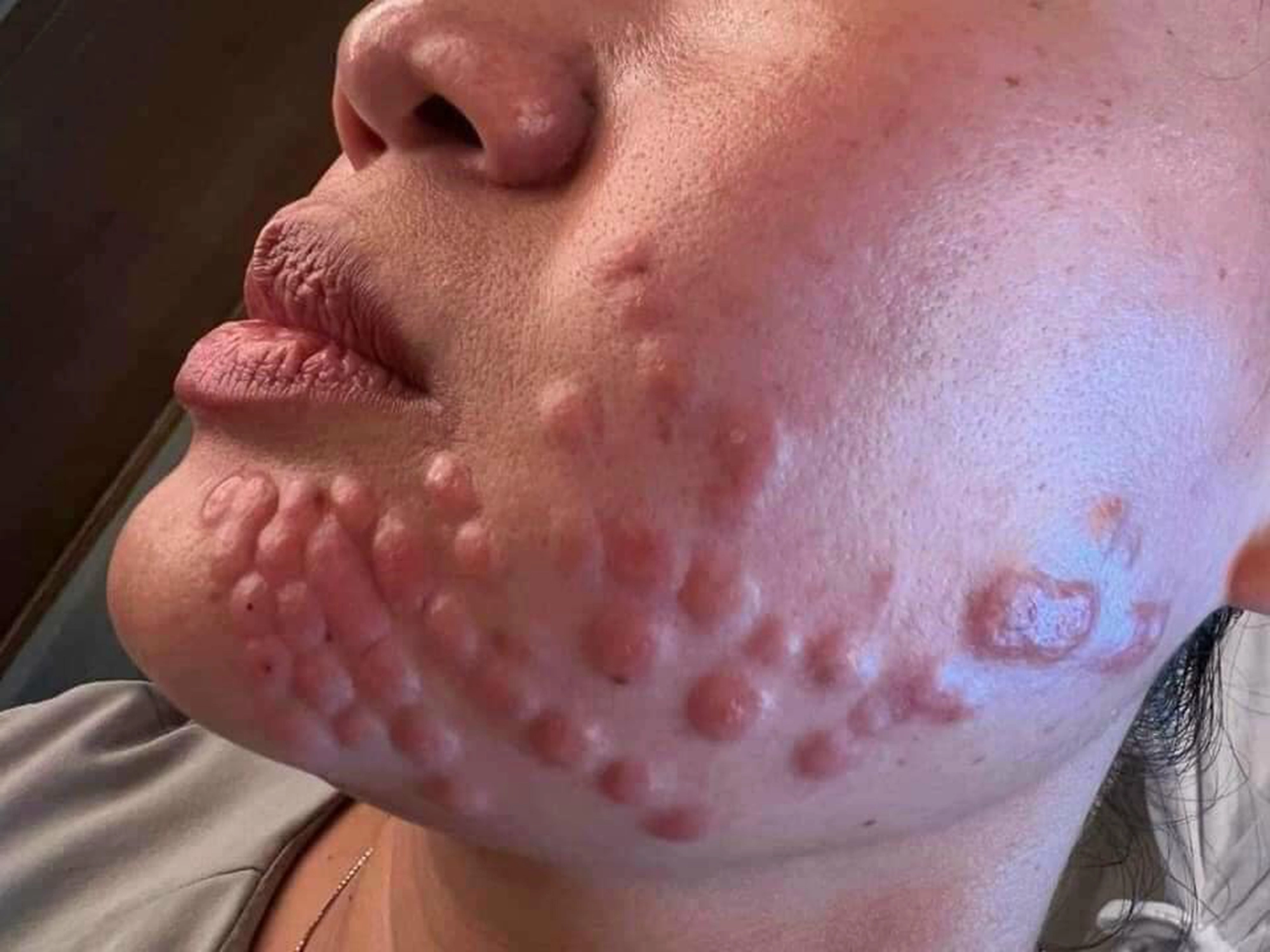 Rước vạ vì ham làm đẹp cấp tốc đón Tết