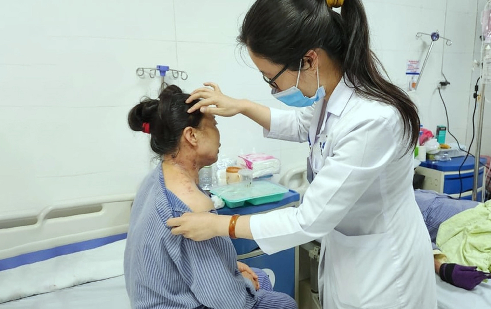 Chớ chủ quan với bệnh giời leo