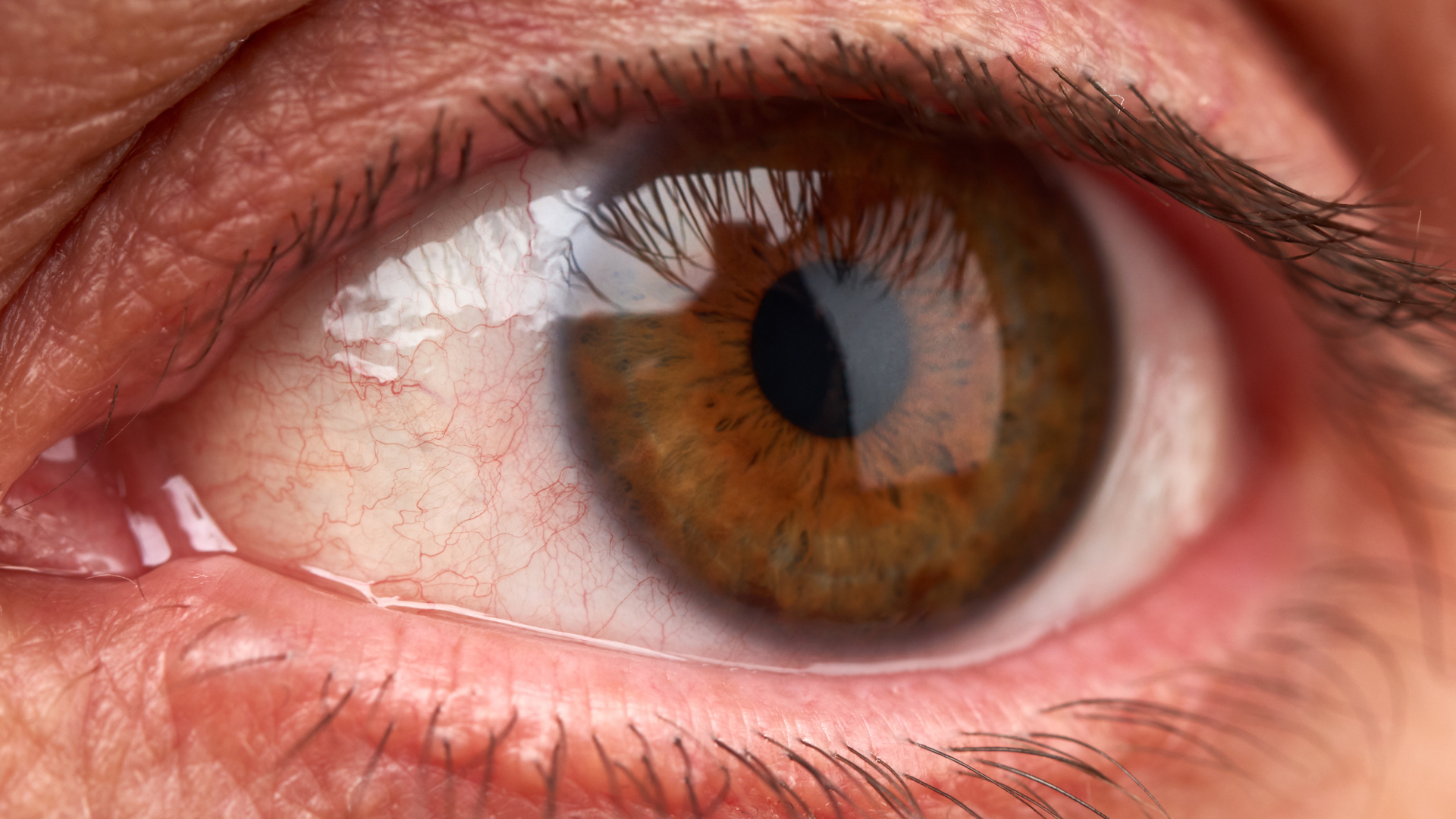 Vitamin B3 có thể giúp giảm gần 70% nguy cơ mắc glaucoma
