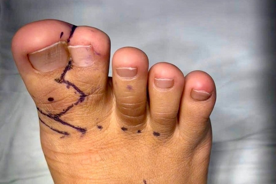 Ca phẫu thuật ứng dụng kỹ thuật tạo h&igrave;nh ti&ecirc;n tiến.