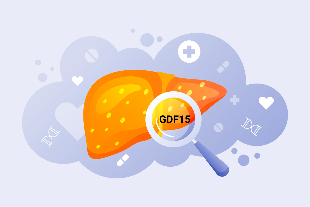 Một hormone giảm cân bảo vệ gan khỏi gan nhiễm mỡ Một hormone giảm cân bảo vệ gan khỏi gan nhiễm mỡ