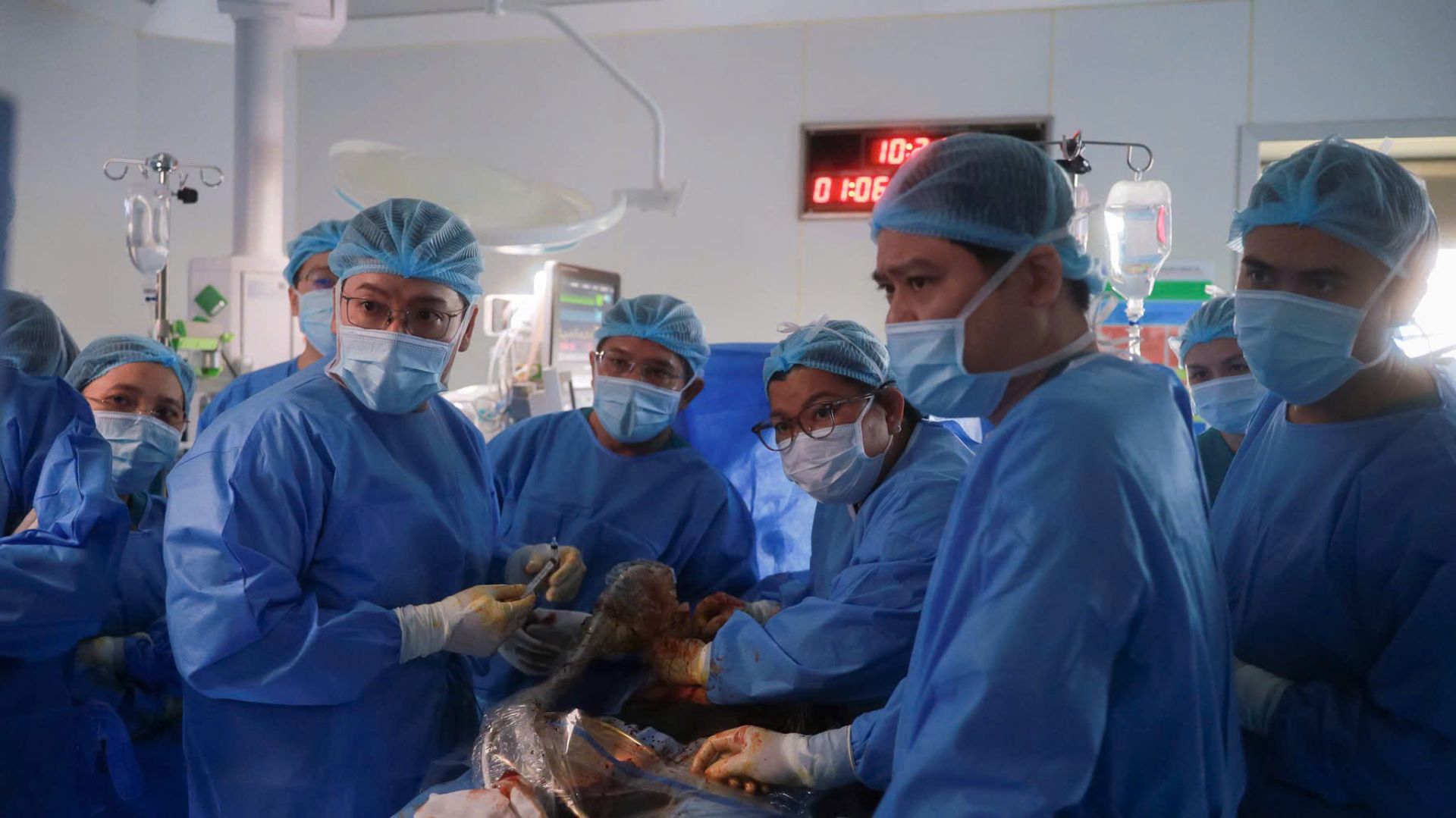 Ê-kíp liên viện Từ Dũ - Nhi Đồng 1 khẩn trương hội chẩn, đưa ra các quyết định kỹ thuật cân não ngay tại bàn mổ khi tim thai gặp biến chứng bất ngờ.